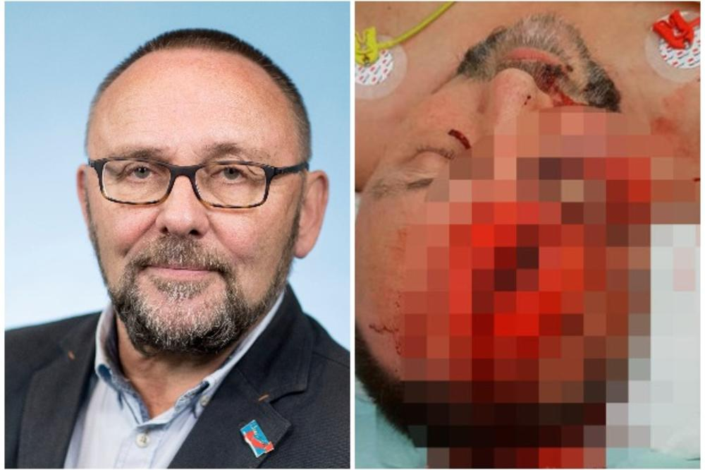 (VIDEO) Preobrat v primeru pretepa nemškega politika AfD: Policija pregledala varnostne kamere in odkrila, da je poslanec lagal!